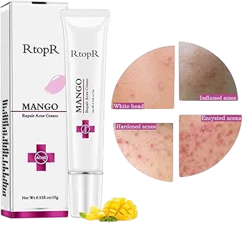 Mango Acne Cream In Pakistan